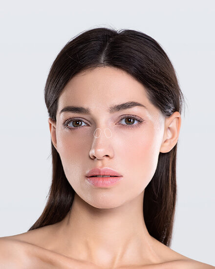 Nasenfalten, California Skin, Ihre Experten für Faltenbehandlungen in München